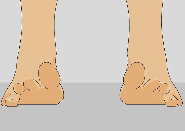 Toes Step 1